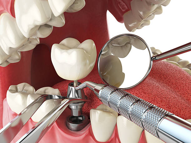 Best Weekend Emergency Dentist in Mount Sterling, OH
